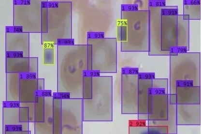 Automated Blood Cell Classification